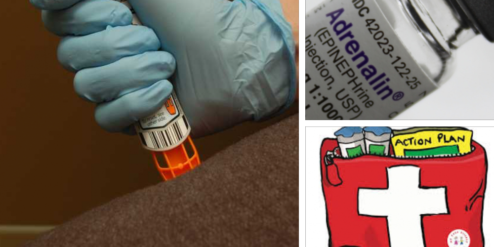 Anaphylaxis for Healthcare Professionals (online webinar)